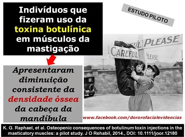 Bruxismo-ATM-DTM-tratamento de bruxismo-tartamento de dtm-tratamento de atm (2)