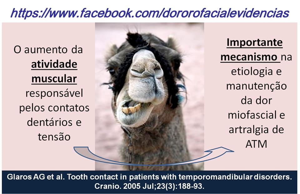 Bruxismo-ATM-DTM-tratamento de bruxismo-tratamento de dtm-dr sergio moura